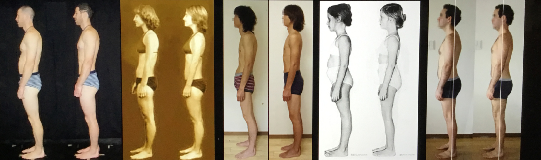 Before-After-Photos