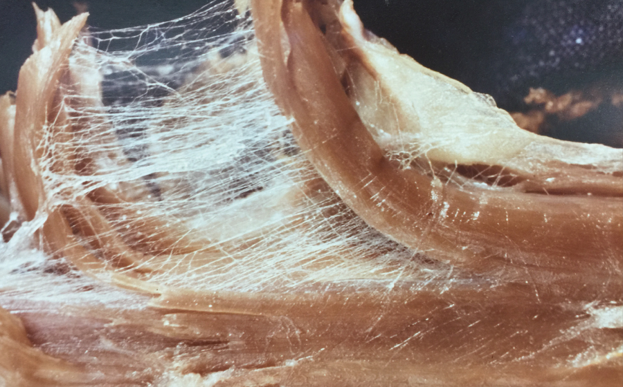 An-Endless-Web-of-Connective-Tissue An-Endless-Web-of-Connective-Tissue